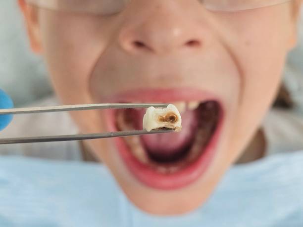 Best Emergency Cosmetic Dentistry in Piedmont, CA